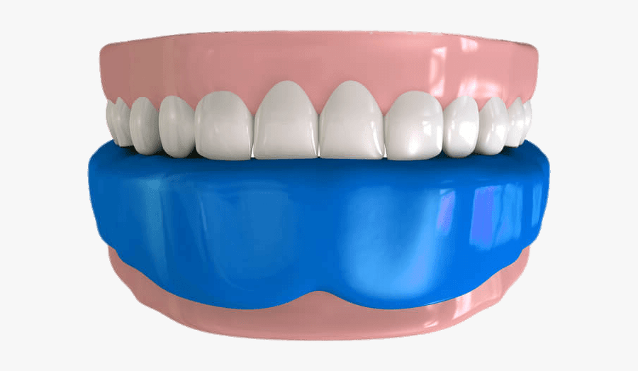 Mouthguard On Lower Teeth Illustration - Jaw, Transparent Clipart