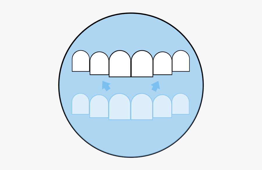 Sparkling Dental - Dentures, Transparent Clipart
