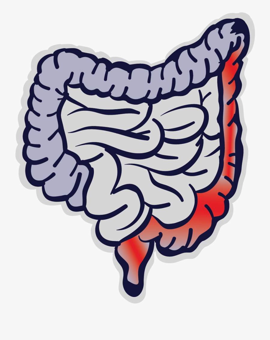 Retocolite Ulcerativa Png, Transparent Clipart