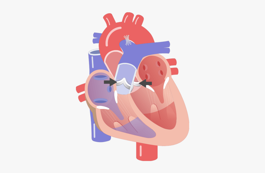 Semilunar Valves Closing Animation Slide - Animated Pic Of The Av Node As Pacer Of The Heart, Transparent Clipart