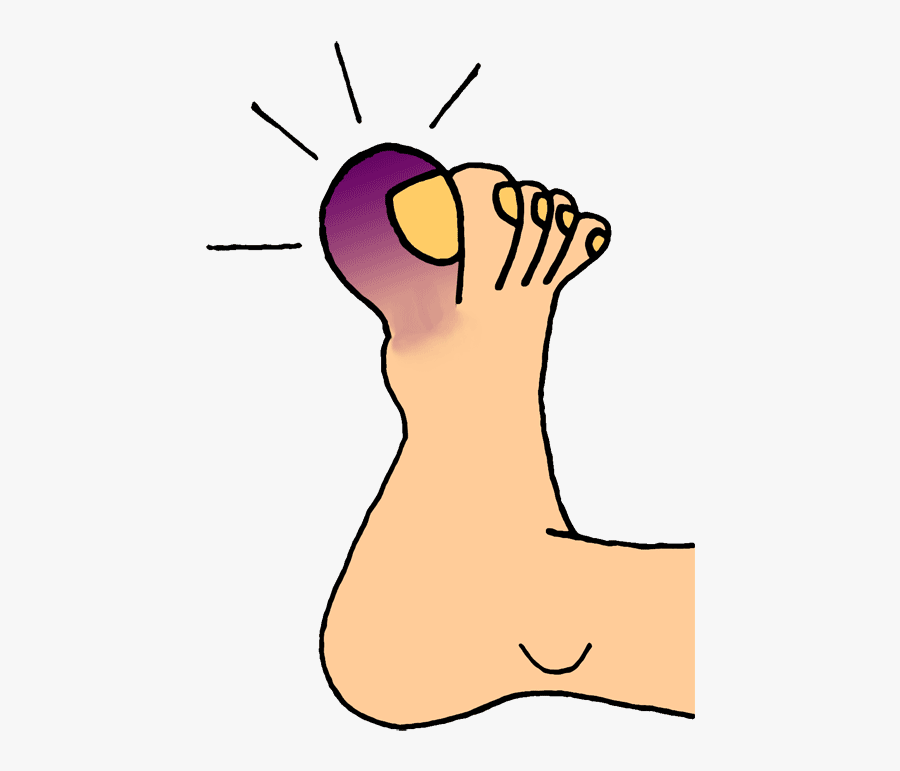 Broken Foot Cartoon - Toe Clip Art, Transparent Clipart