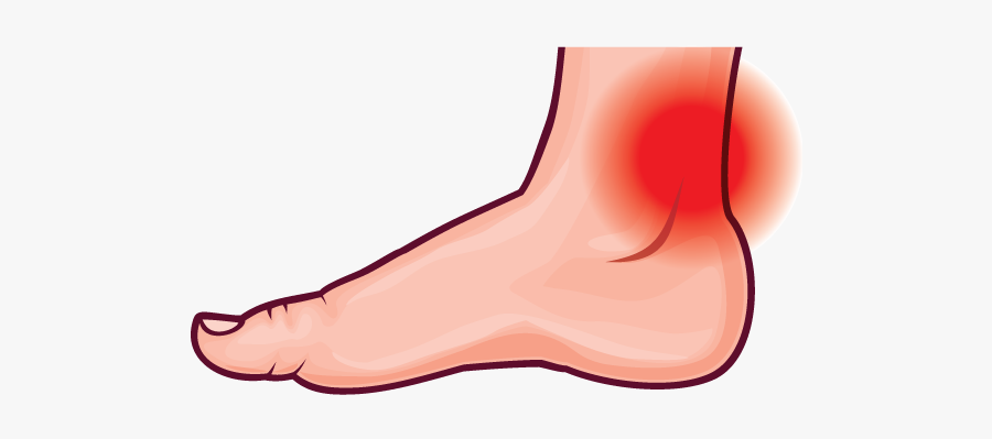 Foot Clipart Foot Pain - Pain In Leg Png, Transparent Clipart