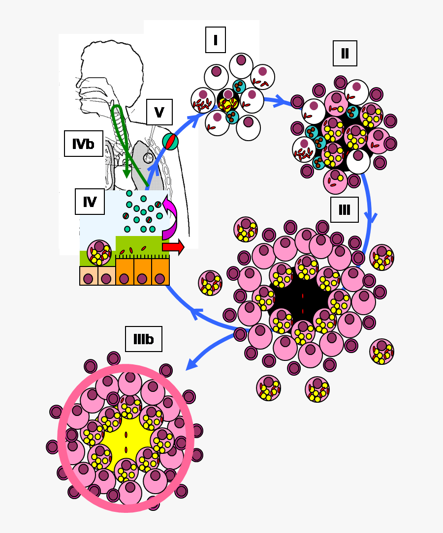 Mycobacterium Tuberculosis Tuberculosis Life Cycle, Transparent Clipart