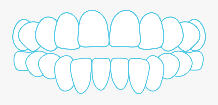 Open Bite - Biting Teeth Transparent Background, Transparent Clipart