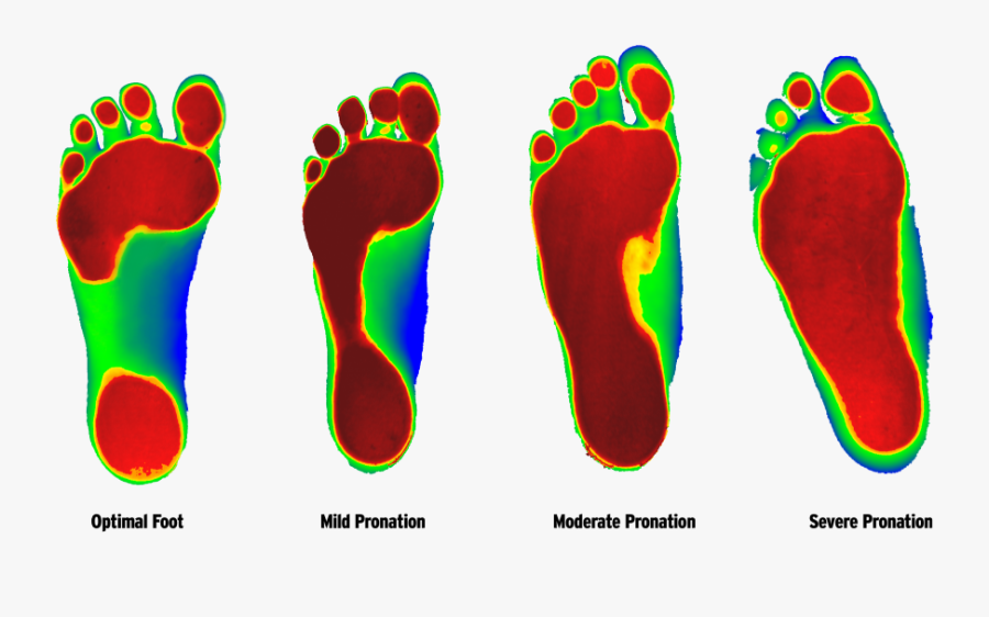 Trade In Pain, Pills And Missed Work For Chiropractic - Flat Feet Levels, Transparent Clipart