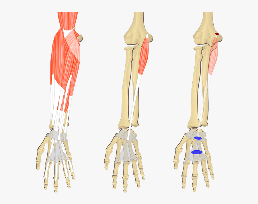 Featured Image Showing Three Images Of The Anterior - Palmaris Longus Vs Flexor Digitorum, Transparent Clipart