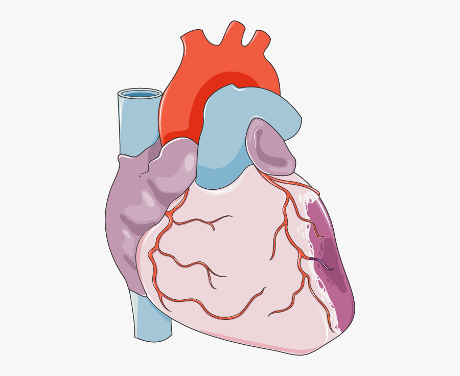 Infarctus Du Myocarde - Heart Macrophage, Transparent Clipart