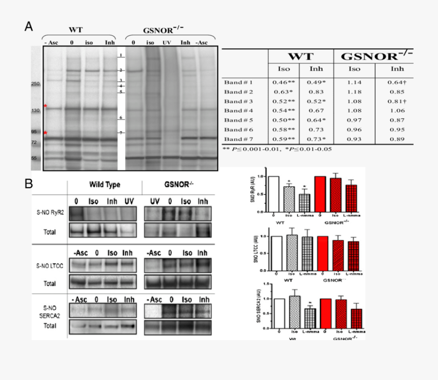Effect Of Iso And Nos On S-nitrosylation Of Proteins - Architecture, Transparent Clipart