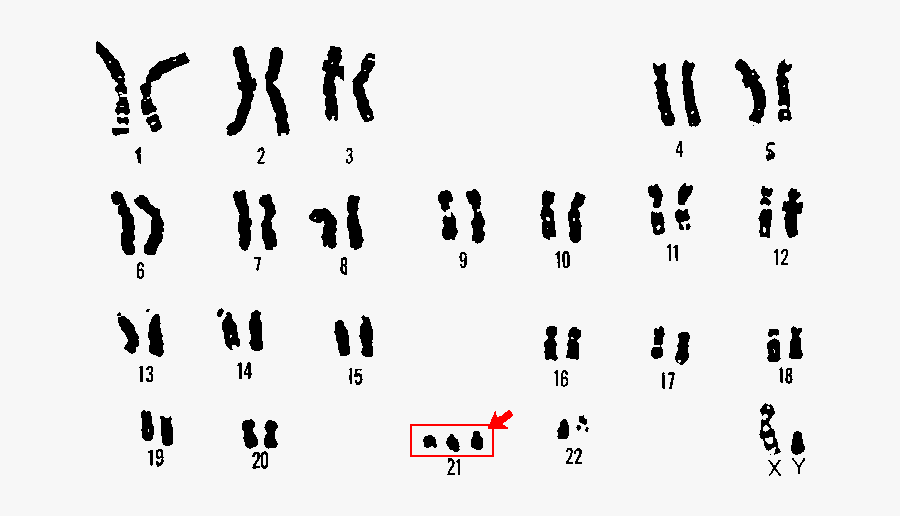 Inheritance Of Mitochondrial And Chloroplast Dna - Down Syndrome Extra Chromosome, Transparent Clipart