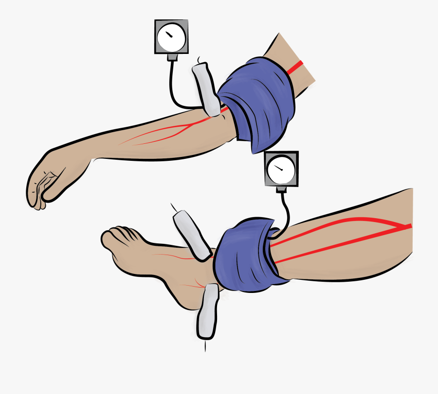 High Jump, Transparent Clipart