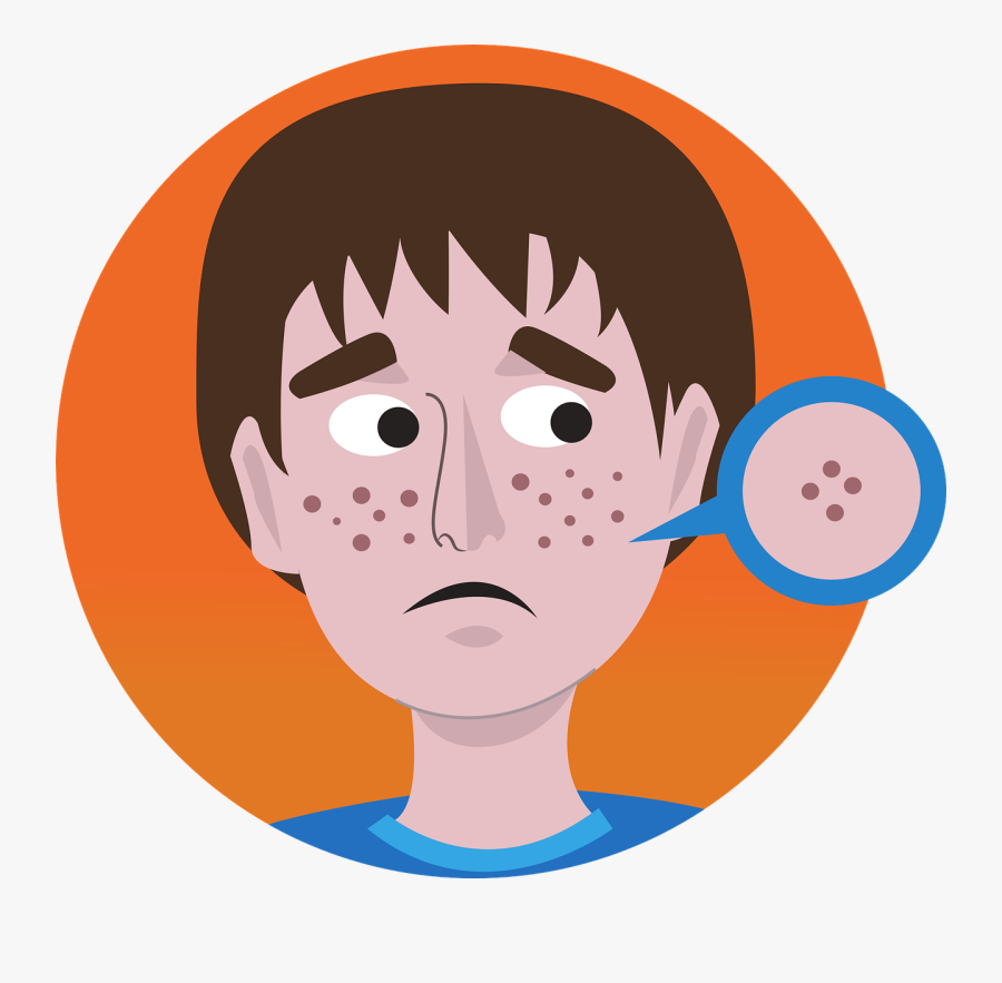 Acne Cartoon Png, Transparent Clipart