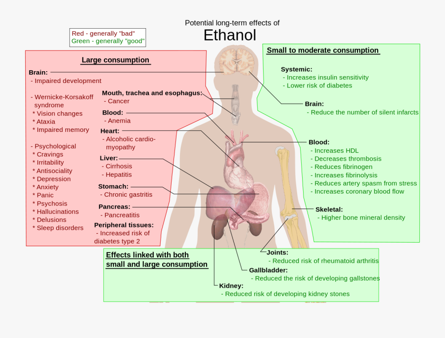 Long Term Effects Of Alcohol, Transparent Clipart