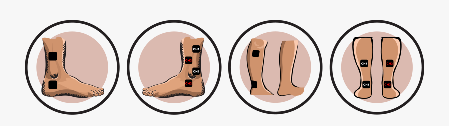 Electrode Pad Placement - Place Tens Pads On Sprained Ankle, Transparent Clipart