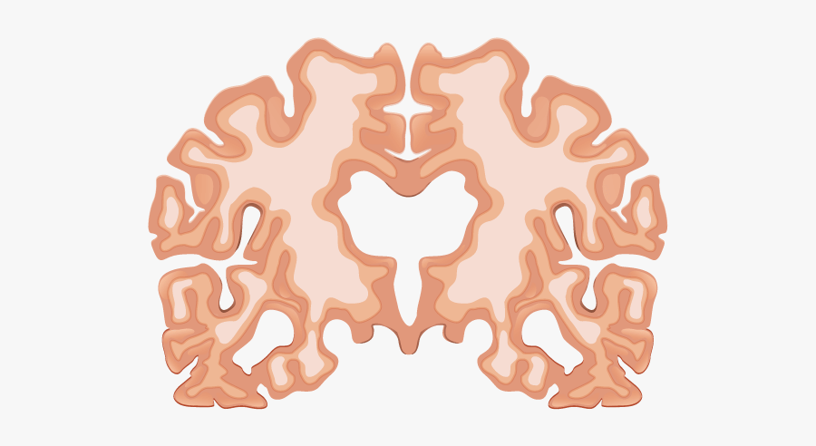 Alzheimer Disease, Transparent Clipart