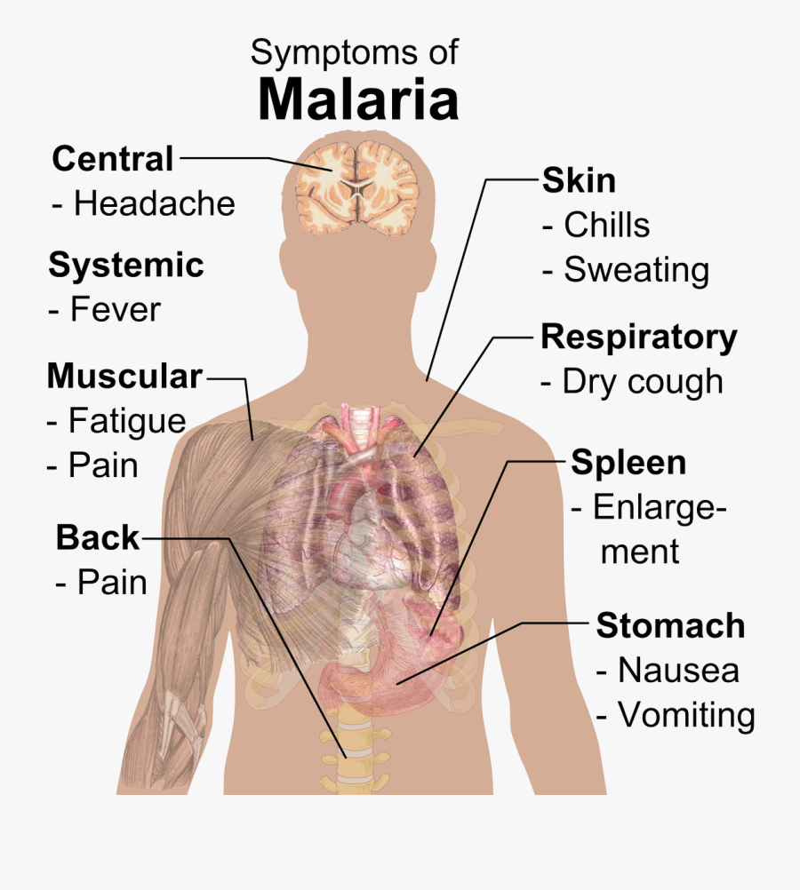 Symptom Of Malaria, Transparent Clipart