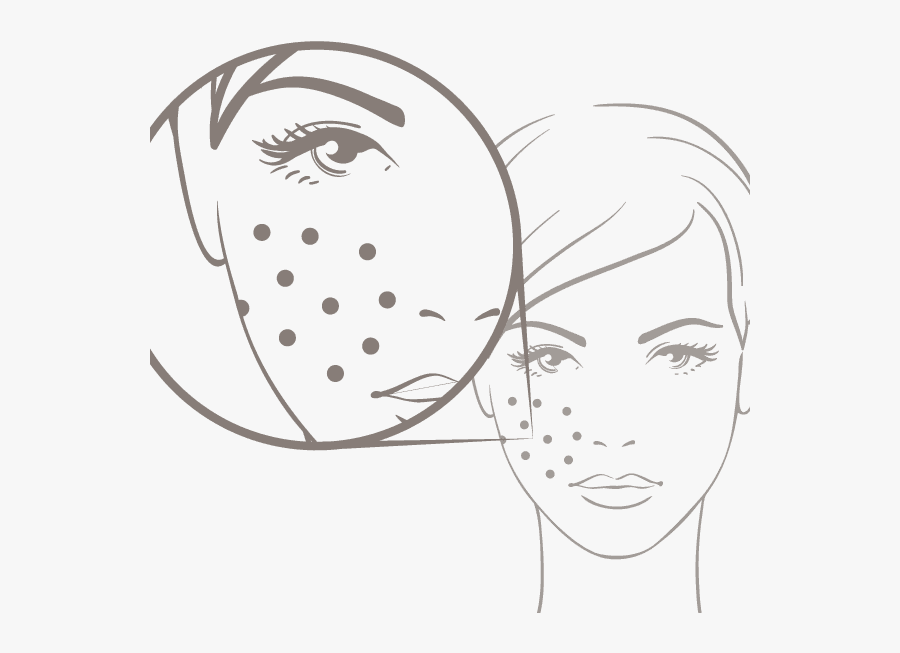 Transparent Acne Clipart - Haut Spiegel Der Seele, Transparent Clipart