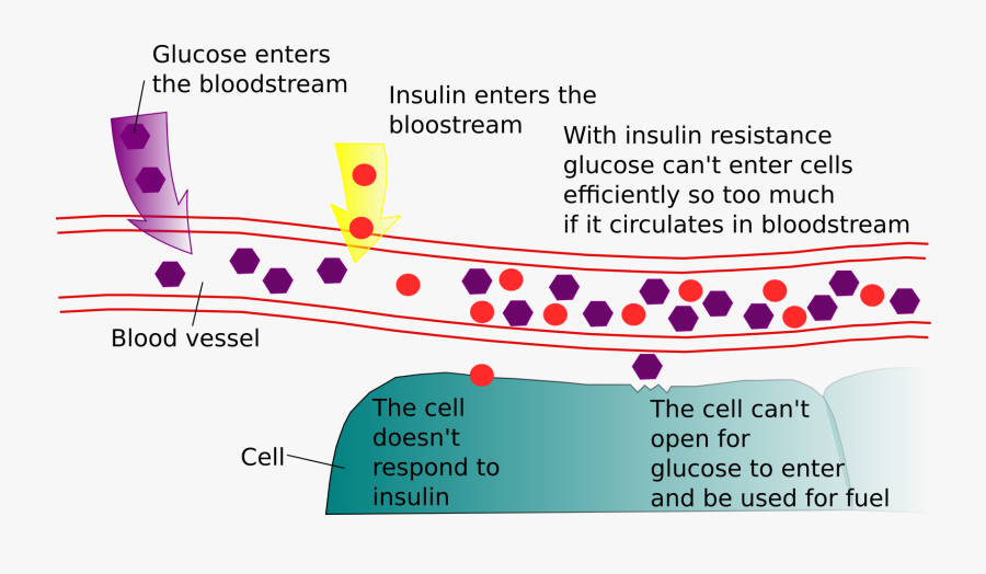 Clip Art Clipart Diabetes And Resistance - Insulin, Transparent Clipart