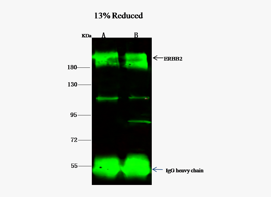 Parallel, Transparent Clipart