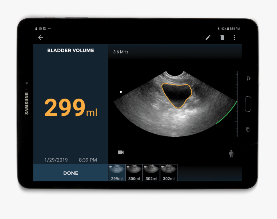Echonous Bladder - Echonous Bladder Scanner, Transparent Clipart