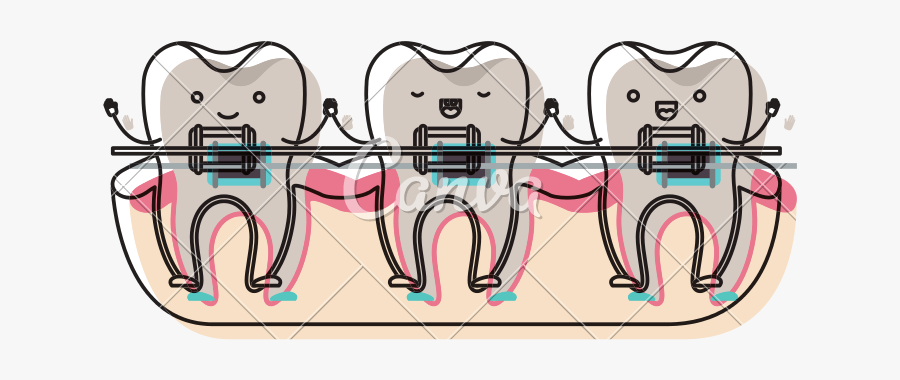 Braces Clipart Tooth Cartoon - Cartoon, Transparent Clipart