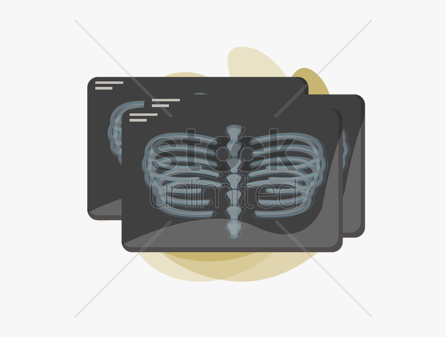 X-ray Of Human Rib Cage V矢量图形 - Illustration, Transparent Clipart