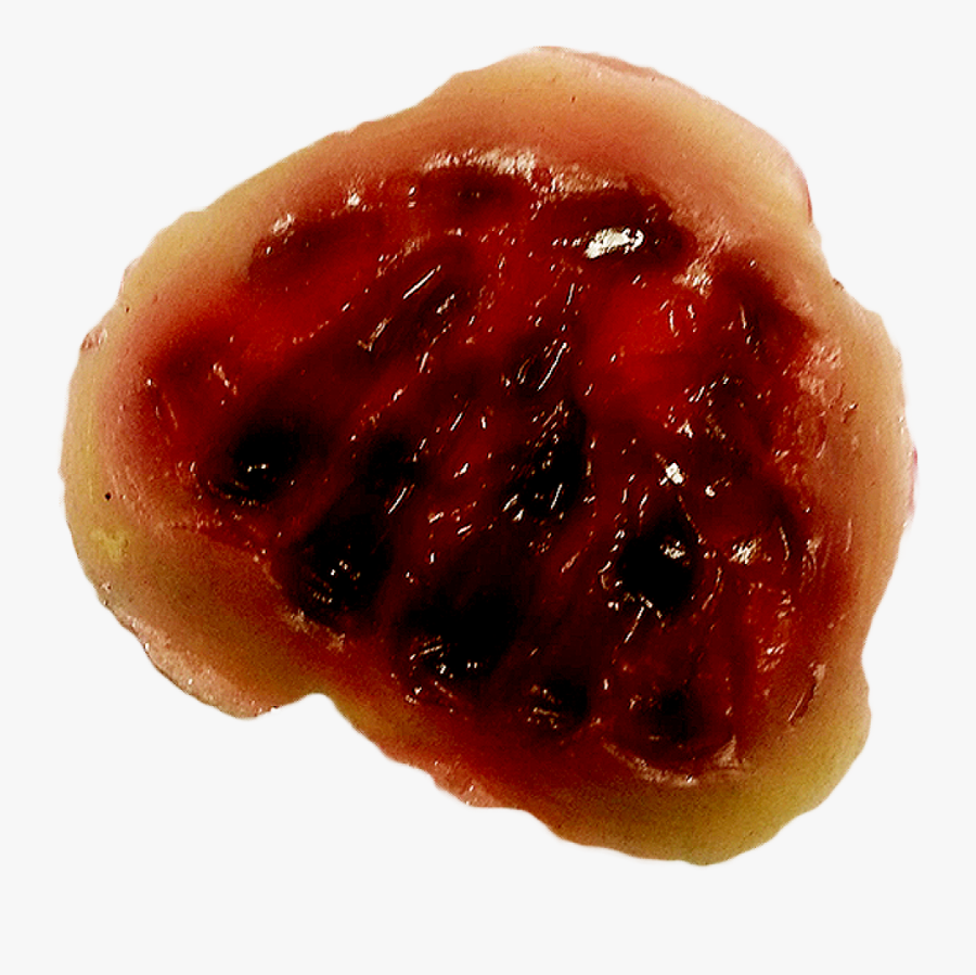 Wound Clip Art Portable Network Graphics Image Injury - Seedless Fruit, Transparent Clipart