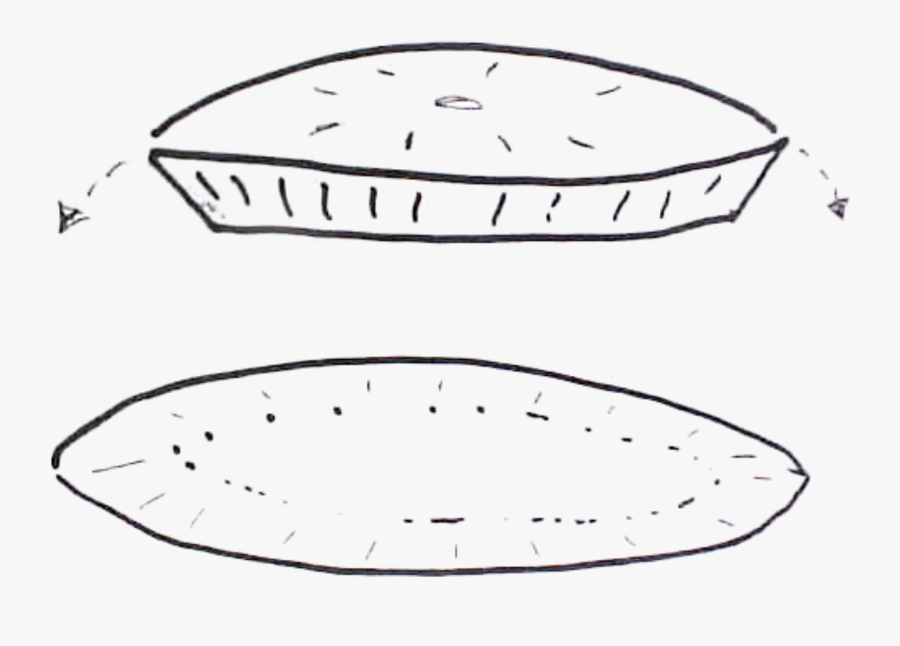 Mohs Peripheral And Deep Margin, Transparent Clipart