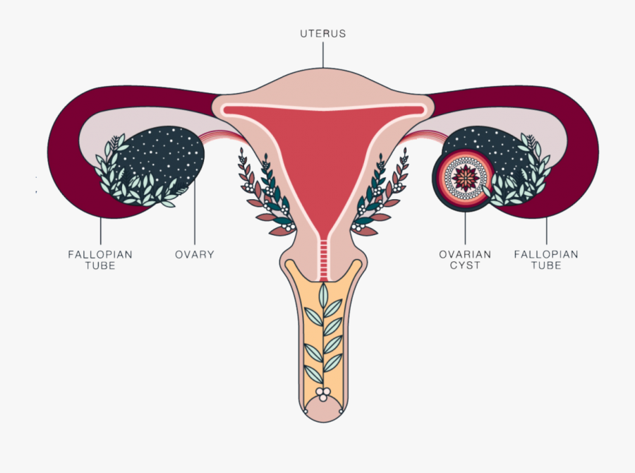 Fibroid Specialist Nyc - Polycystic Ovarian Syndrome Anatomy, Transparent Clipart