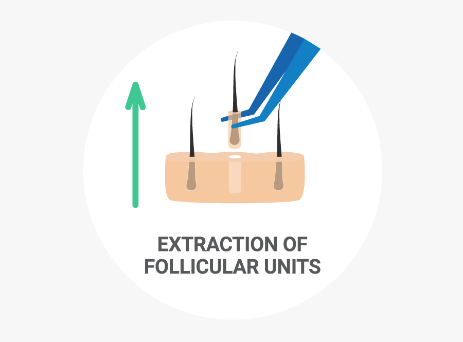 Eyebrow Transplant - Casartigiani, Transparent Clipart
