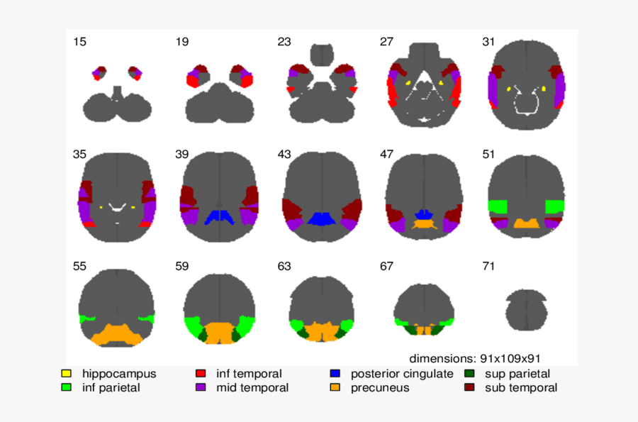 Detailed Atlas For Alzheimer"s Disease Brain Zone Evaluation, Transparent Clipart