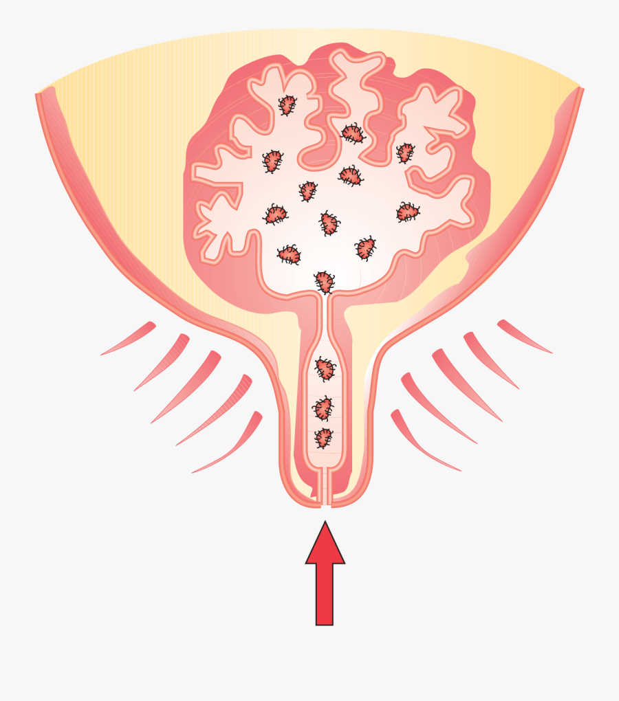 Germ Clipart Soil Bacteria - Mastitis Cartoon, Transparent Clipart