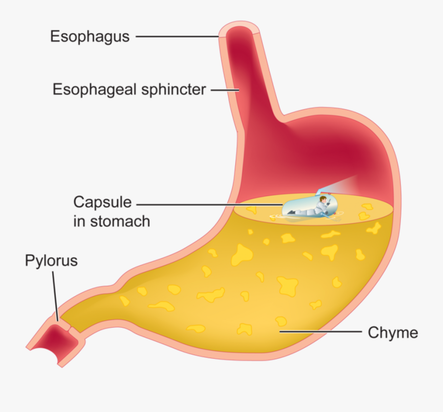 Stomach Chyme, Transparent Clipart