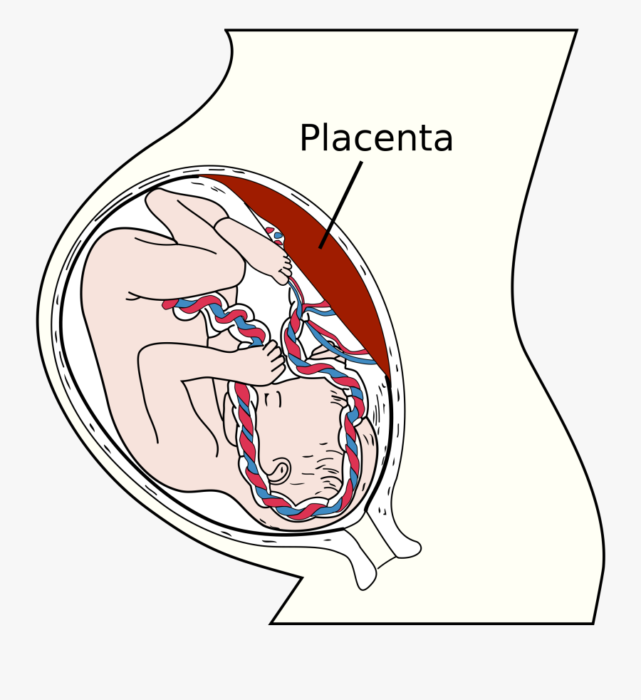 Prenatal Development Linked To Anxiety And Poor Mental - Epilepsy Brain Damage, Transparent Clipart