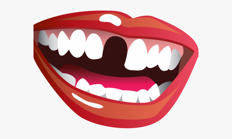 Missing Teeth Clipart, Transparent Clipart