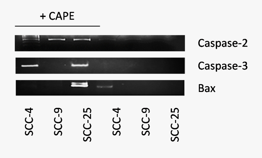 Rt Pcr Screening Of Total Rna Extracted From Oral Cancer - Pescado En Mal Estado, Transparent Clipart