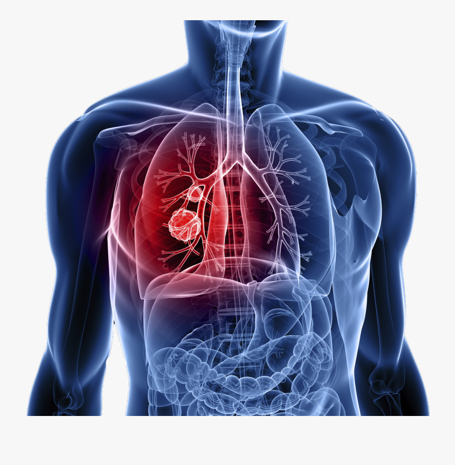 Large Intestine Clipart, Transparent Clipart