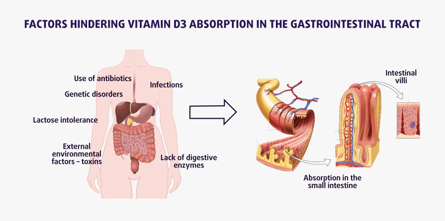 Transparent Small Intestine Png - Digestion Absorption, Transparent Clipart