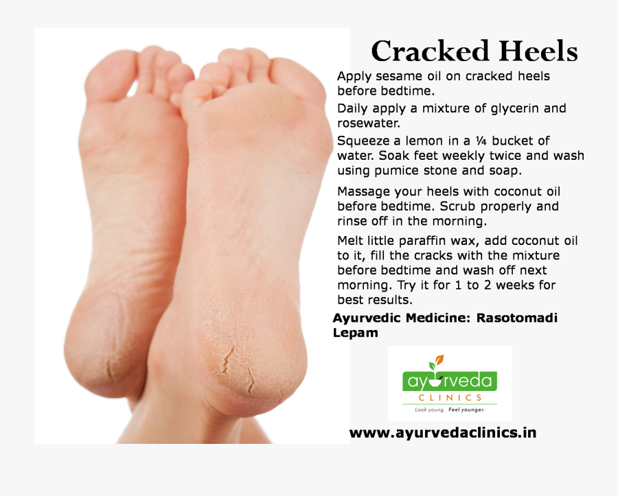 Transparent Foot Body Part - Adult Male Foot Care, Transparent Clipart