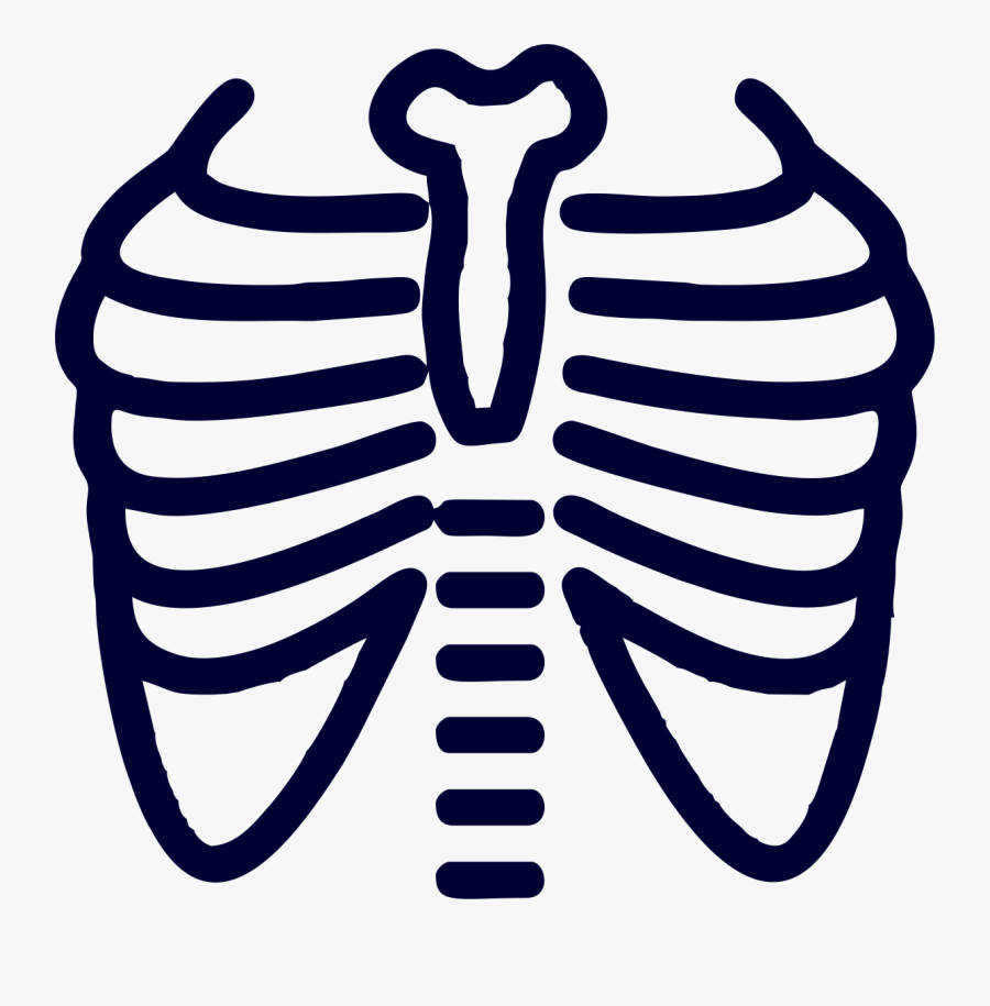 X Ray Chest Radiograph Lung Radiography - Chest X Ray Clipart, Transparent Clipart