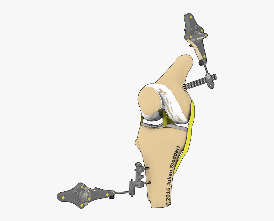 Knee Clipart Thigh - Illustration, Transparent Clipart