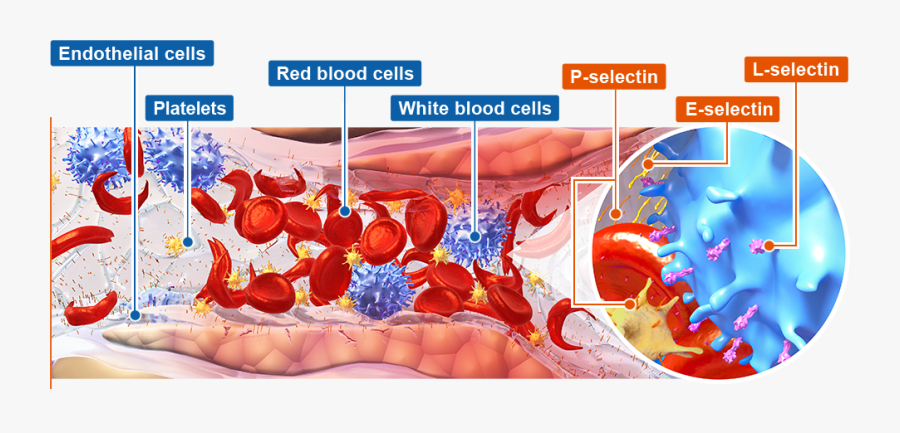 Vaso-occlusive Crises - P Selectin Vaso Occlusive Crisis, Transparent Clipart