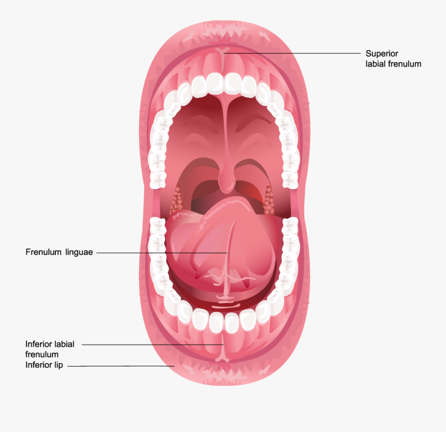 Tongue Clip Frenulectomy Inside Of A Human Mouth , Free Transparent