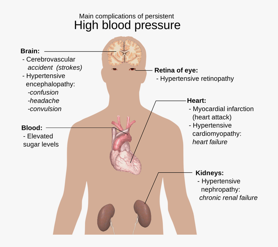Transparent Human Body Png - High Blood Pressure Bad, Transparent Clipart