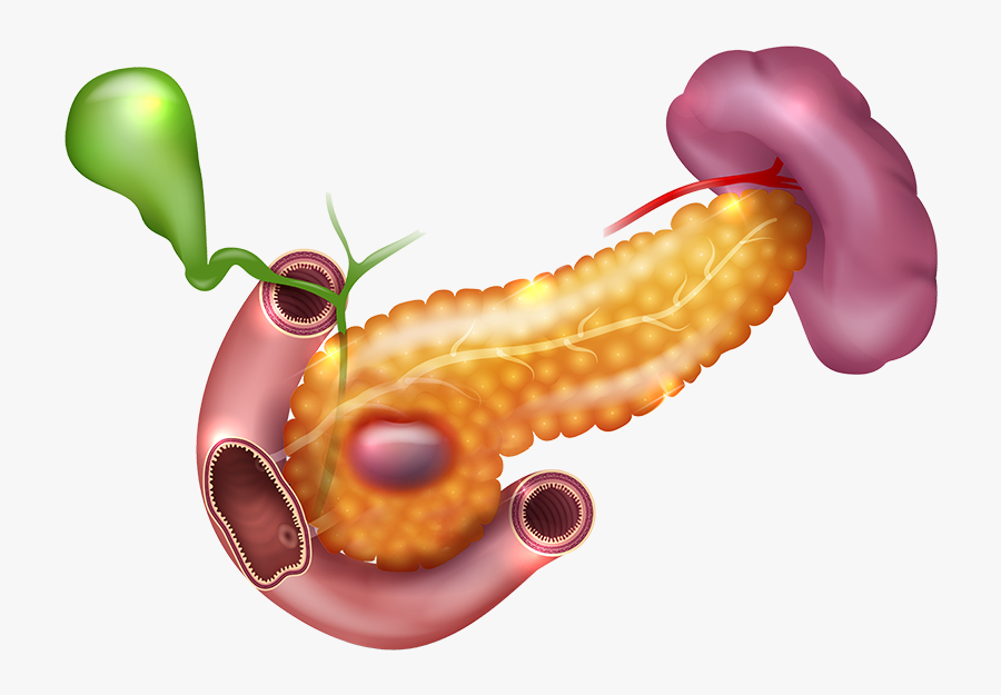 Darkspots In Pancreas - Pancreas Parts, Transparent Clipart