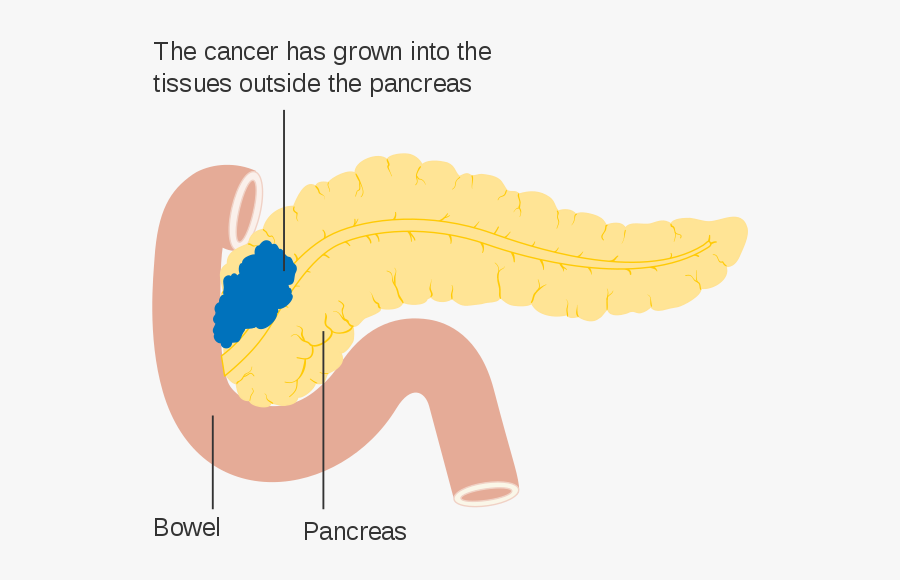 Pancreas Diagram Open, Transparent Clipart