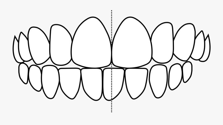 Crooked Teeth, Transparent Clipart