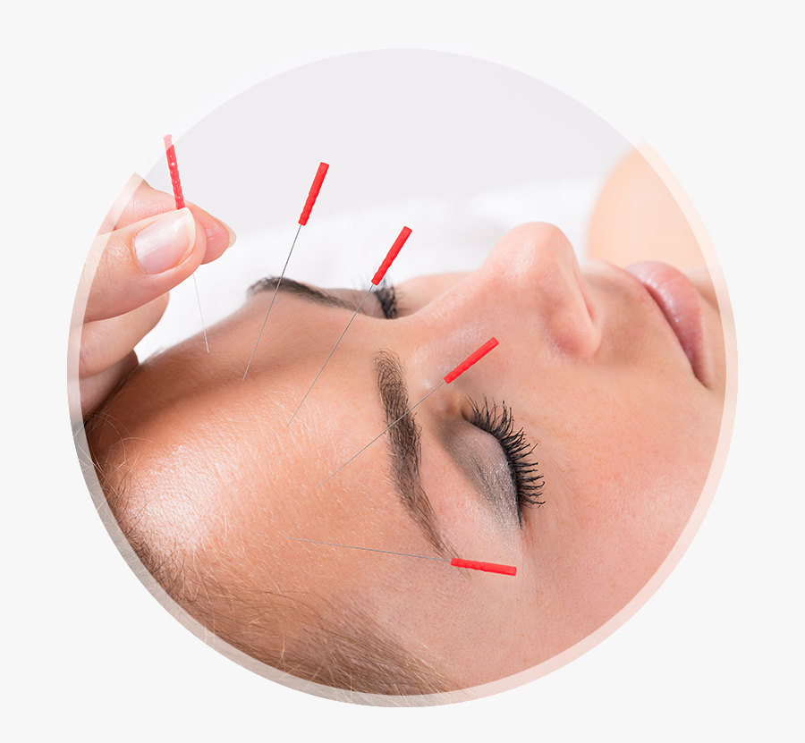 Louisville Acupuncture Clinic Conditions Treated With - Acupuncture Treatment For Allergic Rhinitis, Transparent Clipart