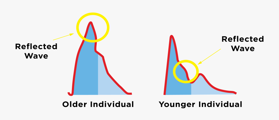 Pulse Wave Velocity Explained - Pulse Wave Velocity, Transparent Clipart