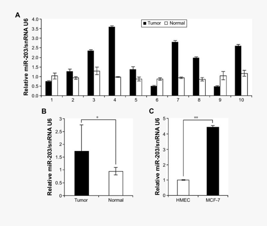 Mir 203 Is Upregulated In Breast Cancer, Transparent Clipart