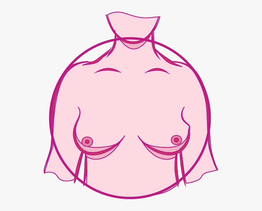 Breast Lumps - Breast Or Nipple Pain, Transparent Clipart